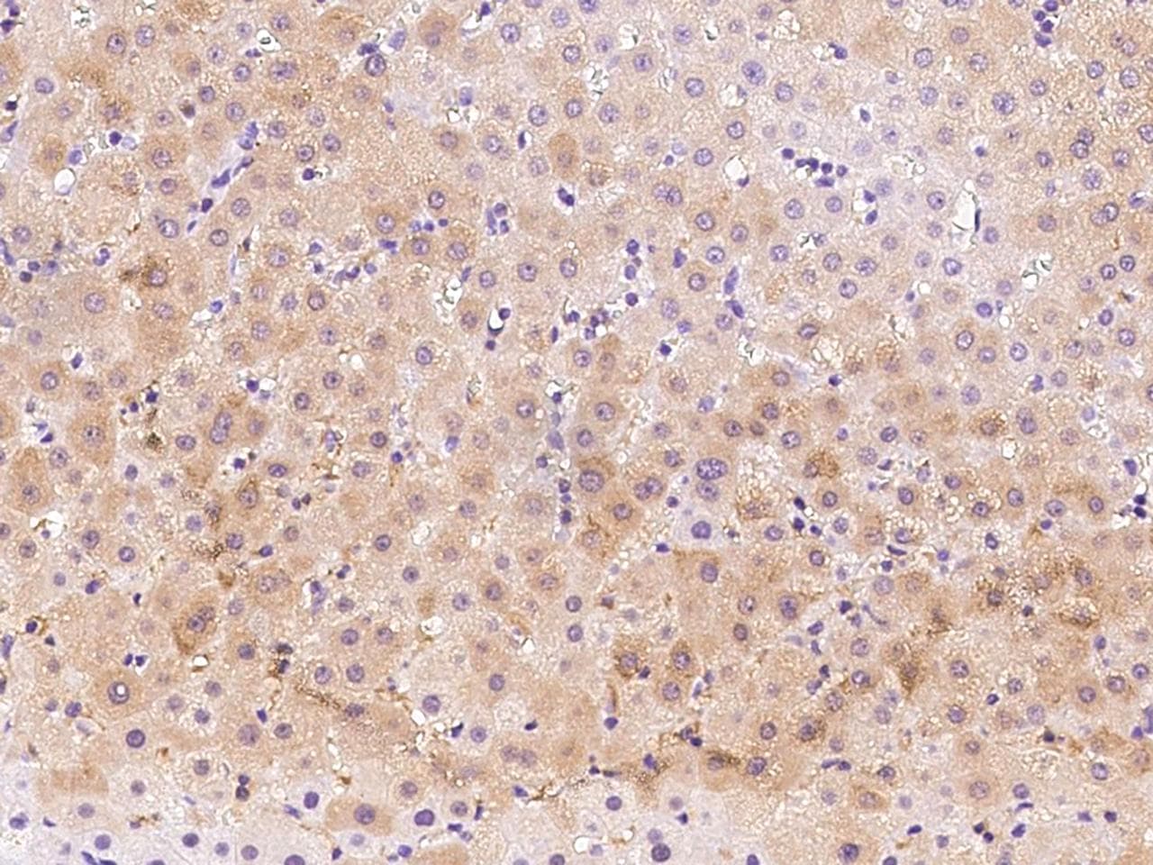 Polyclonal Rabbit anti-Human PSAT1 Antibody (IHC, WB)