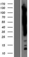 SASH1 Protein (Over-Expression Lysate Myc-DDK (Flag))