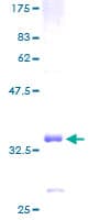 Human GNG3 Protein (Recombinant GST)