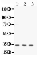 Polyclonal Rabbit anti-Human CNN1 / Calponin Antibody (aa283-297, IHC, WB)