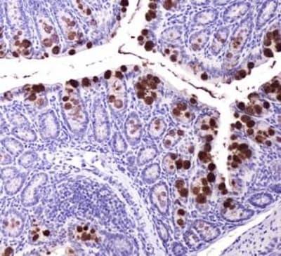 ABCG8 Antibody (clone 1B10A5)