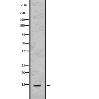 Polyclonal Rabbit anti-Human CCL2 / MCP1 Antibody (IHC, WB)