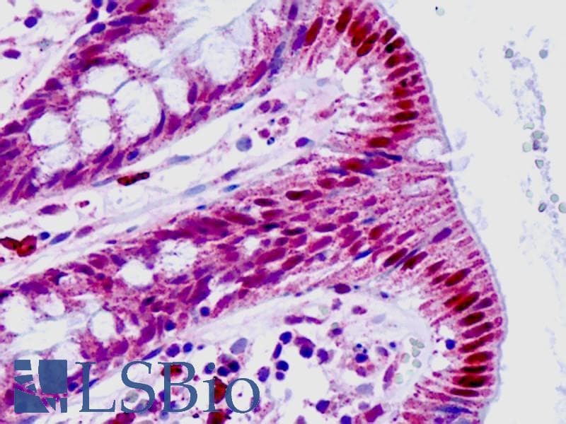 IHC-plus™ HEXIM1 Antibody (aa181-230)