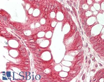 IHC-plus™ Polyclonal Rabbit anti-Human XPO5 / Exportin 5 Antibody (IHC, IF, WB)