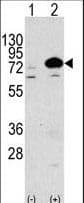 Polyclonal Rabbit anti-Human Apg7 / ATG7 Antibody (aa22-51, IHC, WB)