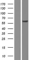 CAMK2B / CaMKII Beta Protein (Over-Expression Lysate Myc-DDK (Flag))