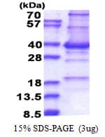 Human CENPP Protein (Recombinant His)