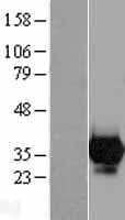 CA7 / Carbonic Anhydrase VII Protein (Over-Expression Lysate Myc-DDK (Flag))