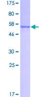 Human KHK / Ketohexokinase Protein (Recombinant GST)