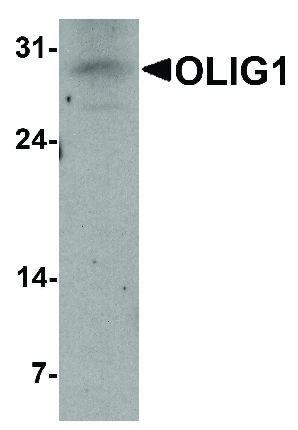 OLIG1 Antibody