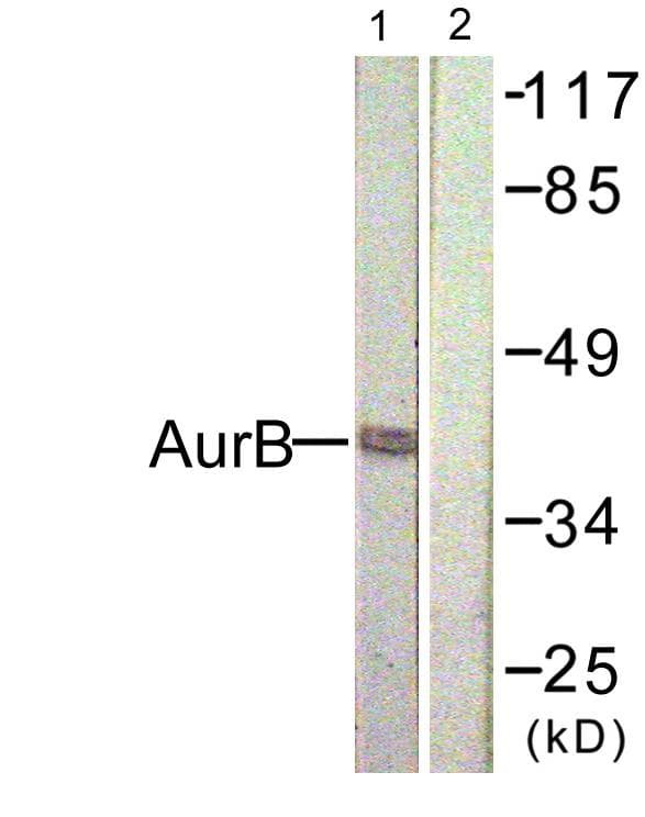 AURKB / Aurora-B Antibody (p232)