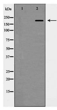 ITGB4 / Integrin Beta 4 Antibody