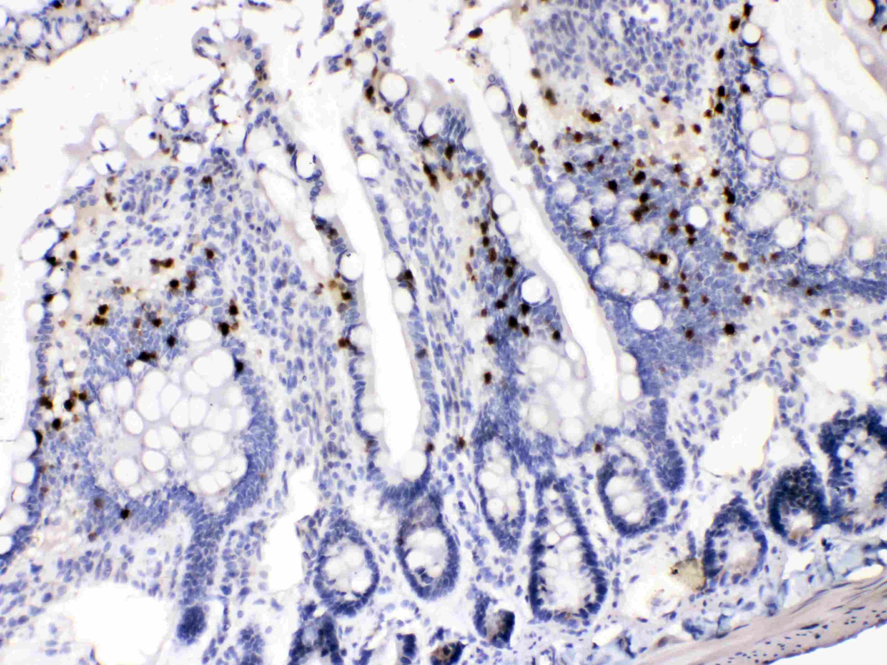 AKR1B1 / Aldose Reductase Antibody