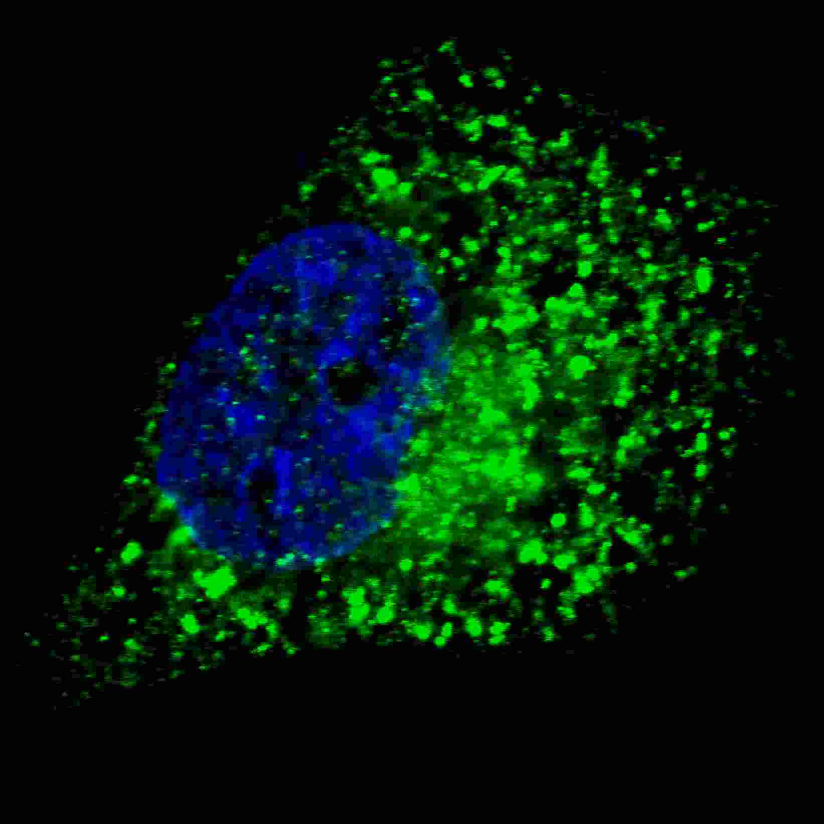 Polyclonal Rabbit anti-Human GABARAP Antibody (aa1-30, IHC, IF, WB)