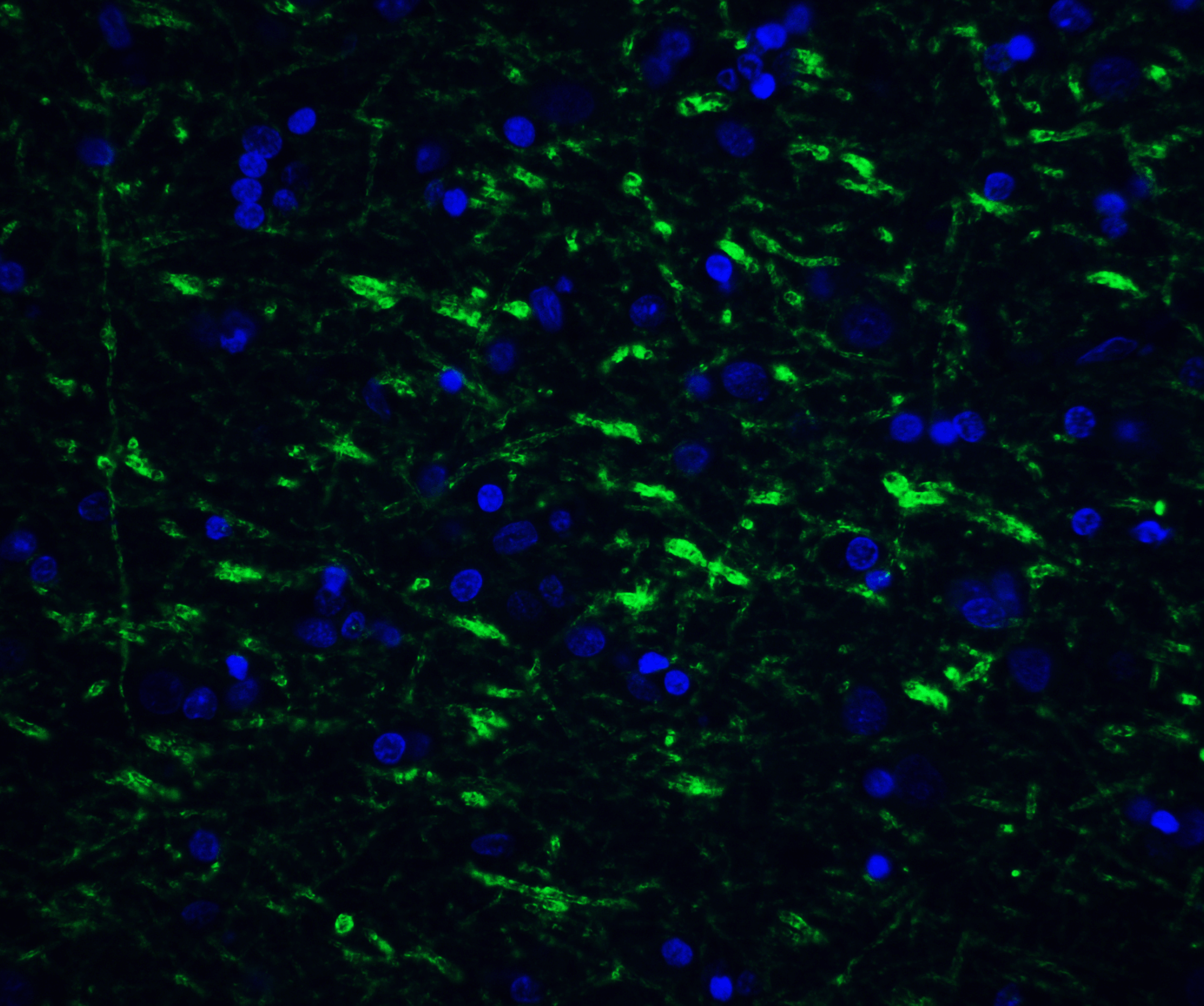 IHC-plus™ TOLLIP Antibody