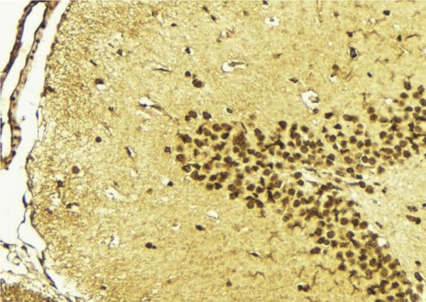 GATA5 Antibody