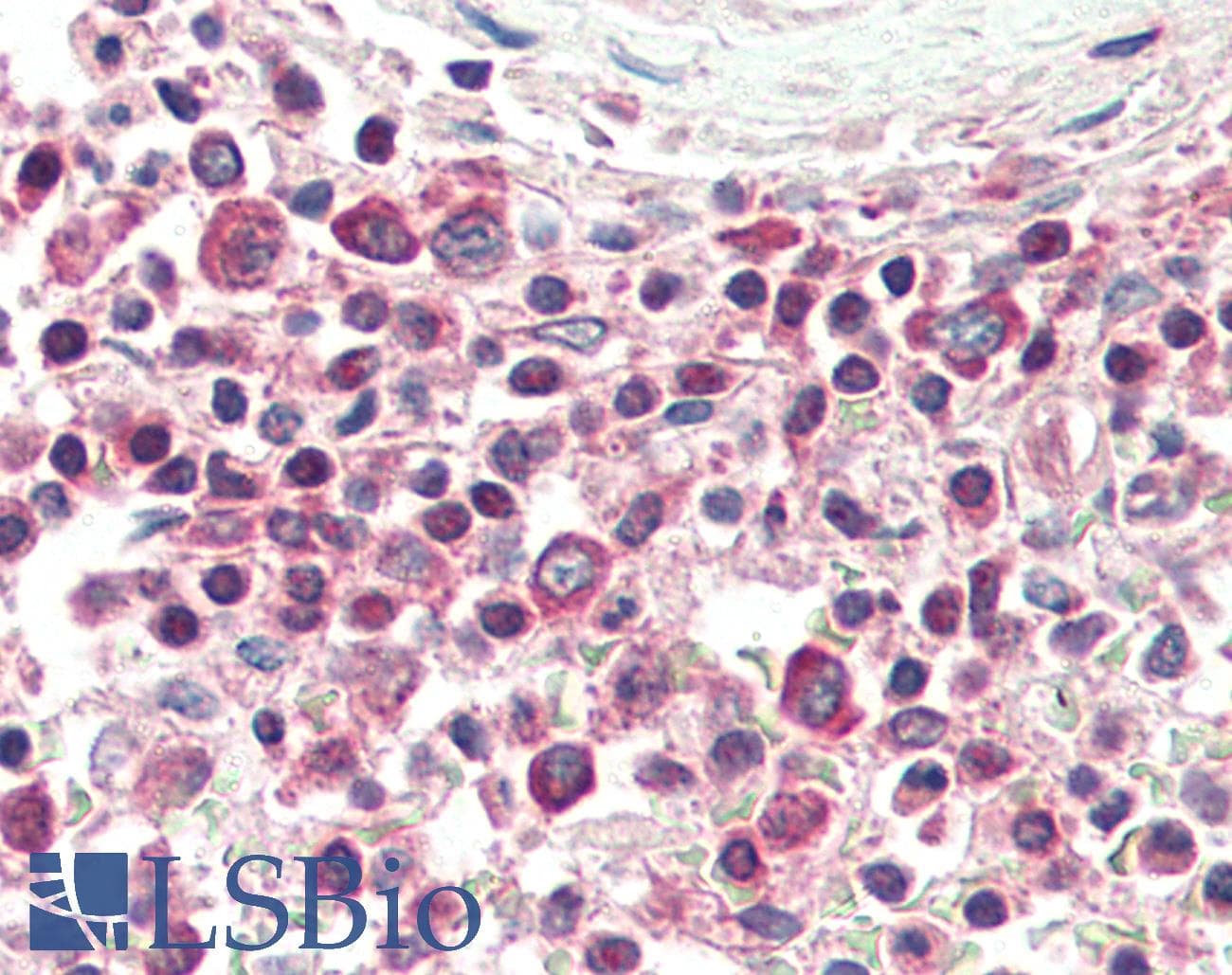 IHC-plus™ Polyclonal Rabbit anti-Human TNFSF13 / APRIL Antibody (IHC, WB)