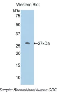 ODC1 / Ornithine Decarboxylase Antibody (aa234-453)