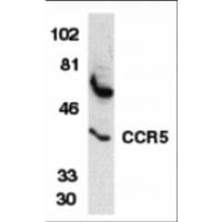 CCR5 Antibody