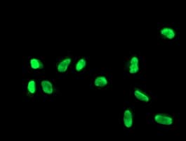 Monoclonal Mouse anti-Human FGFR2 / FGF Receptor 2 Antibody (clone OTI5F7, IF, WB)