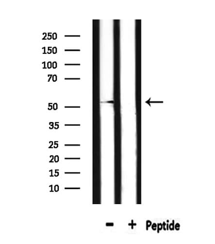 DRD2 / Dopamine Receptor D2 Antibody