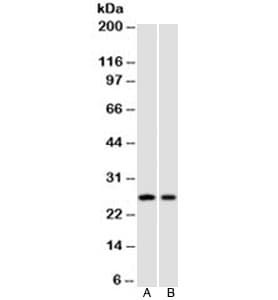 CDKN1B / p27 Kip1 Antibody (clone SPM348, Azide-free, BSA-free)