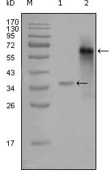 NCOA3 / SRC-3 / AIB1 Antibody (clone 2C11B12)