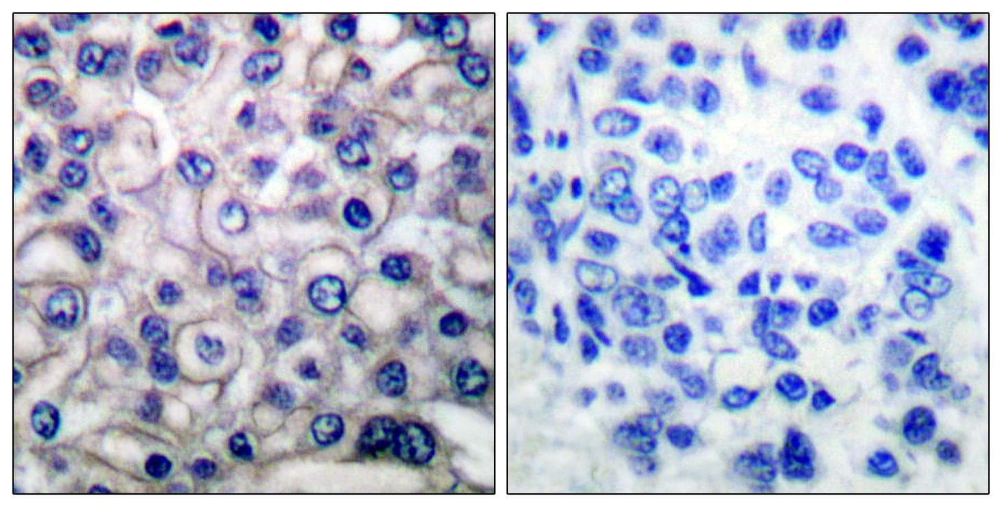 EGFR Antibody (p693)