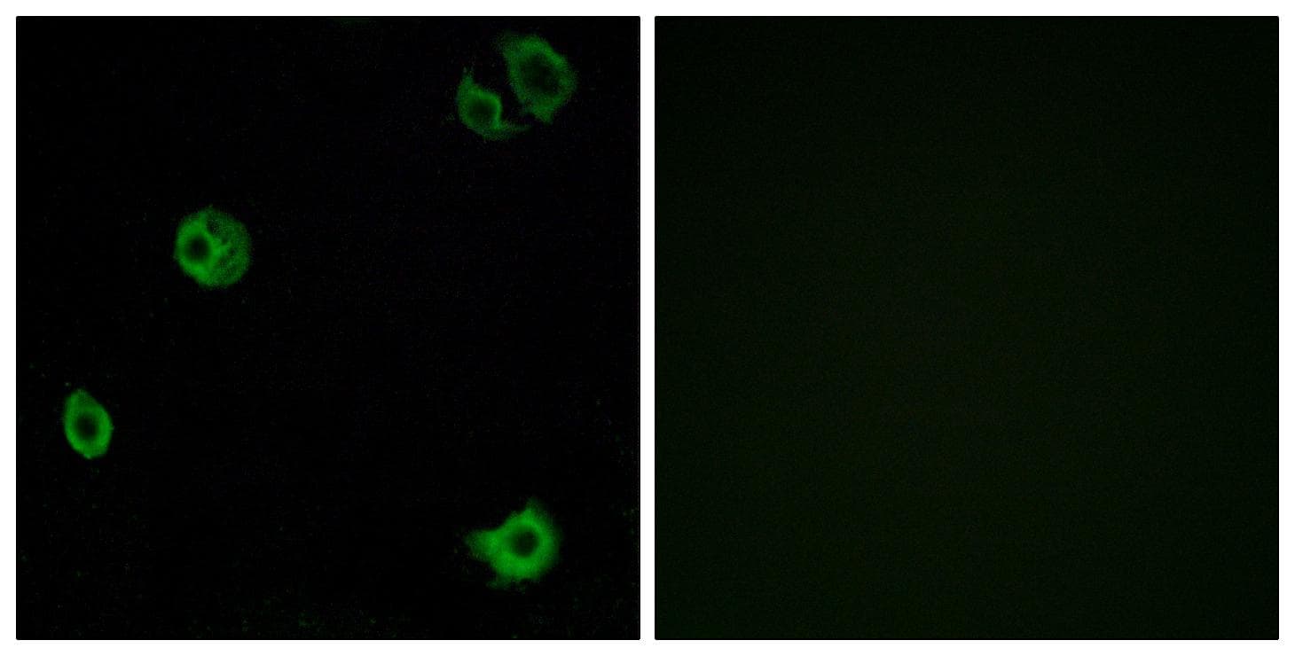 Polyclonal Rabbit anti-Human ADGRF1 / GPR110 Antibody (IF, WB)