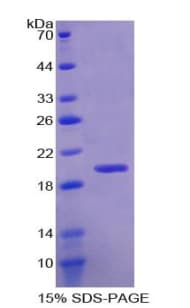 Human RBM20 Protein (Recombinant His)