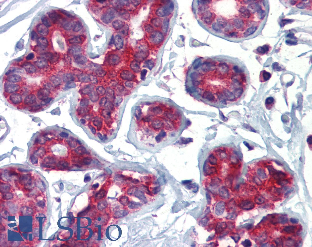 Polyclonal Rabbit anti-Human TAL1 Antibody (C-Terminus, IHC, WB)