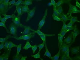 Monoclonal Mouse anti-Human CD32A Antibody (clone OTI16E7, IHC, IF, WB)