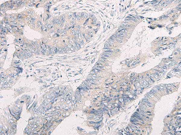 WNK4 Antibody