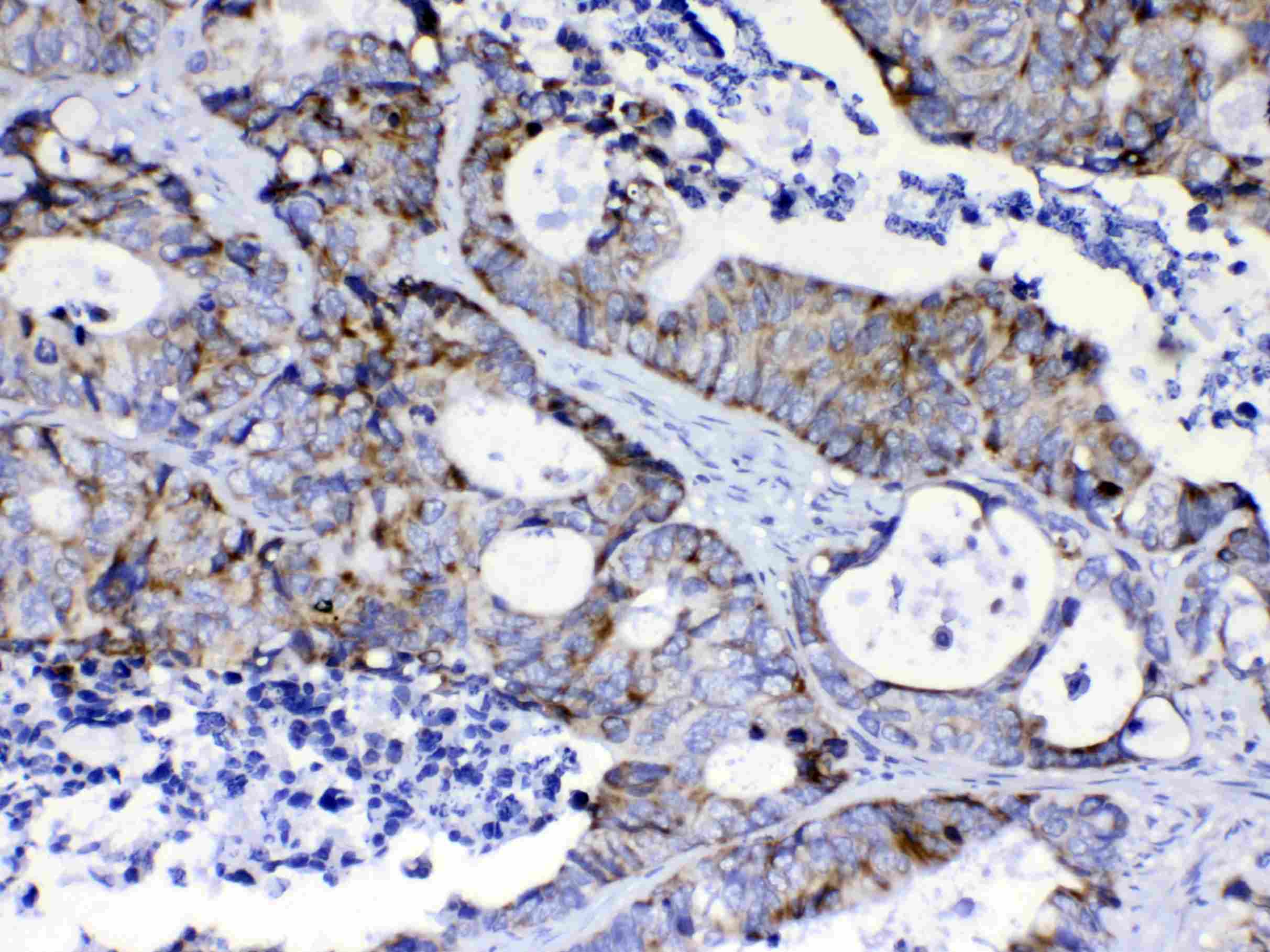 PIK3CB / PI3K Beta Antibody