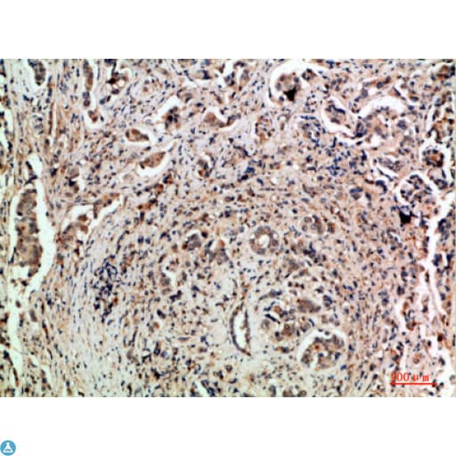 TLE1 / TLE 1 Antibody