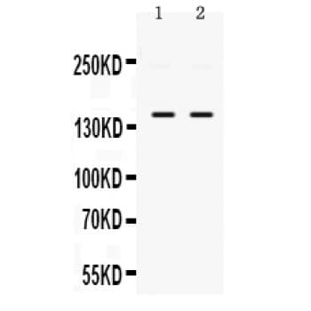 PPP1R12A / MYPT1 Antibody (aa1-40)
