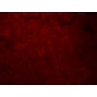 Polyclonal Rabbit anti-Human SLCO1B1 / OATP2 Antibody (IF, WB)
