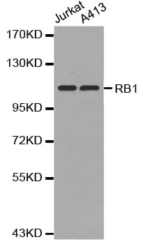 RB1 / Retinoblastoma / RB Antibody
