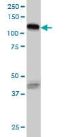 EPHB3 / EPH Receptor B3 Antibody (clone 1B3)