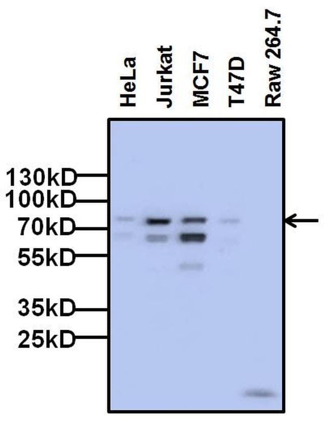 Monoclonal Mouse anti-Human FOXP1 Antibody (clone 6E4C4, Amino Acid: 481-677, WB)