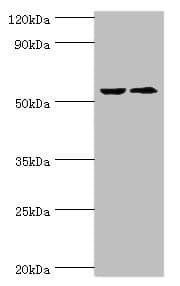 IHC-plus™ Polyclonal Rabbit anti-Human CASP8 / Caspase 8 Antibody (IHC, WB)