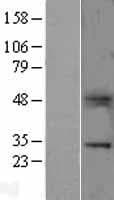 VTCN1 / B7-H4 Protein (Over-Expression Lysate Myc-DDK (Flag))