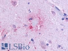 PathPlus™ OR51E1 Antibody (C-Terminus)