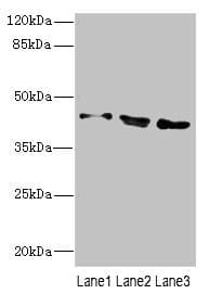 CAMK1D Antibody