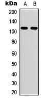 IHC-plus™ EPHA6 / EPH Receptor A6 Antibody (C-Terminus)
