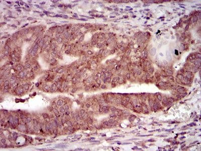 PRKACG Antibody (clone 20000)