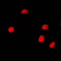 NCOR2 / SMRT Antibody (Internal)