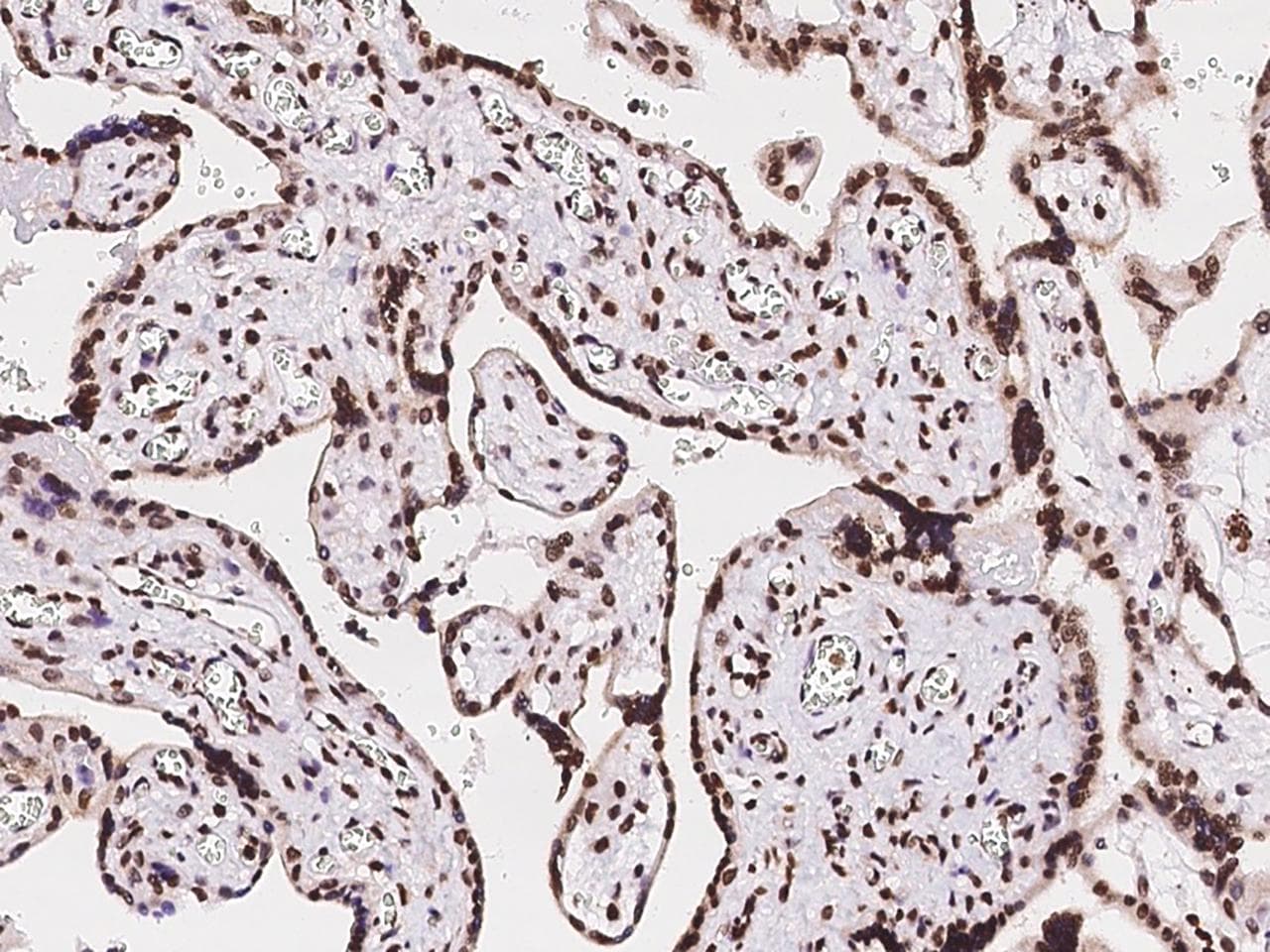 MBD5 Antibody (Preservative Free)