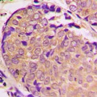Polyclonal Rabbit anti-Human SNCA / Alpha-Synuclein Antibody (C-Terminus, IHC, IF, WB)