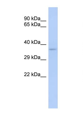 TRADD Antibody (C-Terminus)